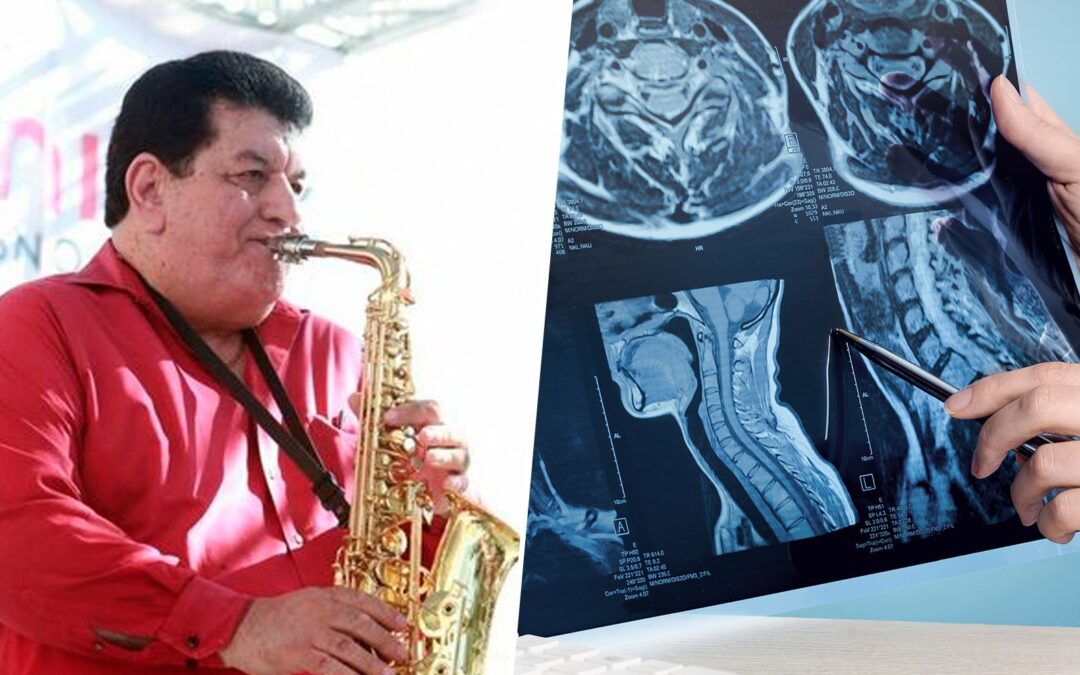 Fito Olivares: ¿Qué es el mieloma múltiple, el cáncer que padecía el saxofonista?