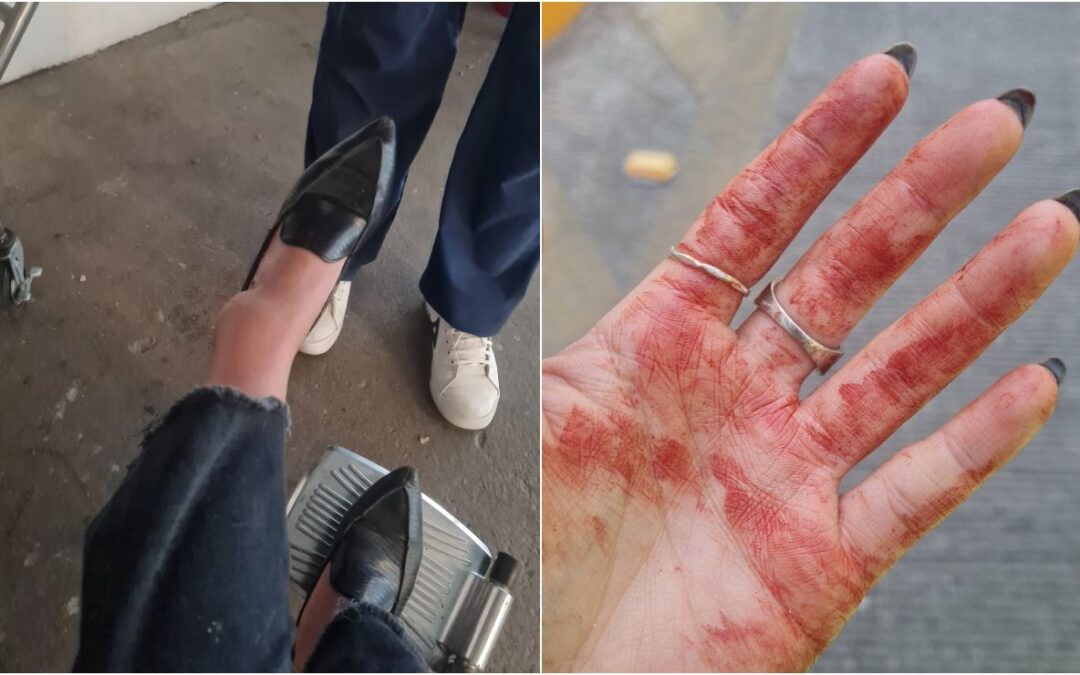 Mujer salta de camión en CDMX: ‘el chofer no me quería dejar bajar, salgo con golpes, pero viva’