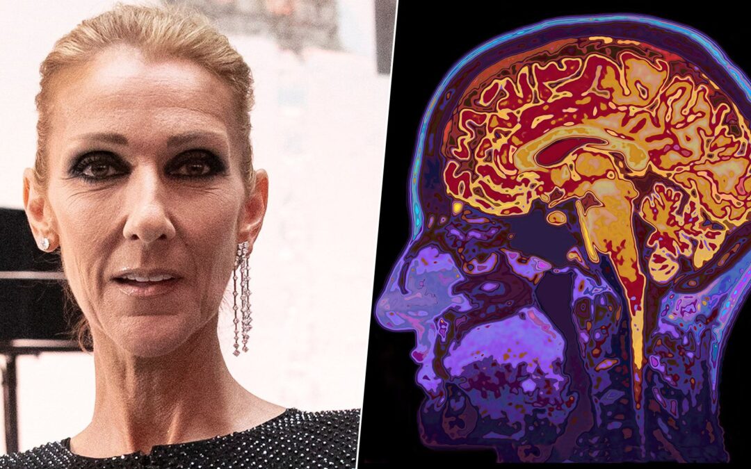 Celine Dion: ¿Qué es el síndrome de la persona rígida, enfermedad que padece la cantante?