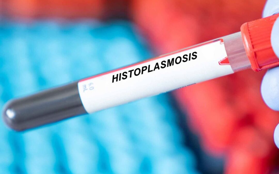 Histoplasmosis, el hongo que se propagó en cenotes de Yucatán: ¿Qué es y cuáles son sus riesgos?