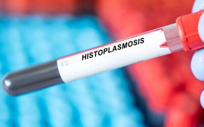 Histoplasmosis, el hongo que se propagó en cenotes de Yucatán: ¿Qué es y cuáles son sus riesgos?