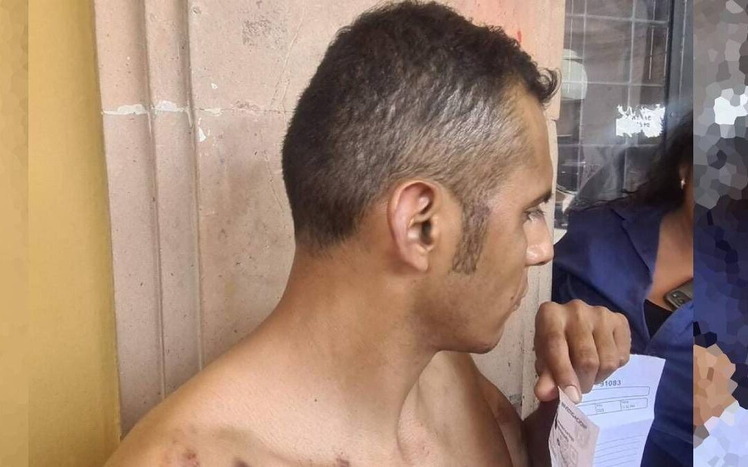 Reportero de Guanajuato acusa a policías municipales de golpearlo y torturarlo