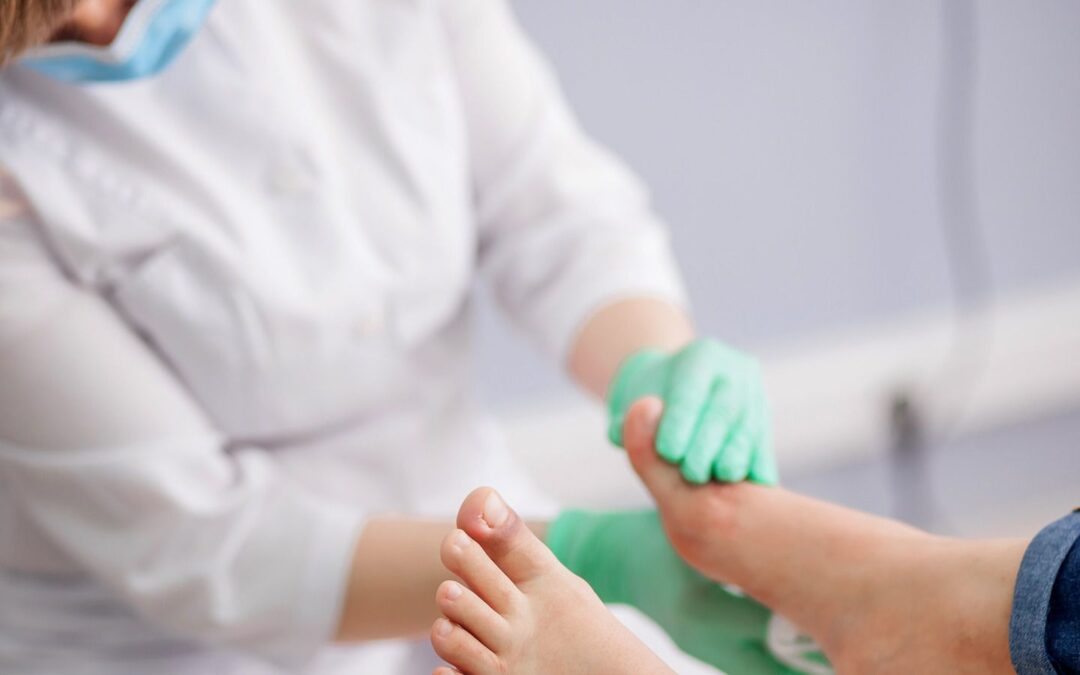 Pie diabético: ¿Cuándo ir al doctor para prevenir amputaciones y cómo cuidar tu piel?