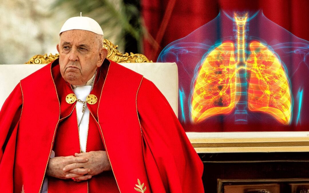 Salud del Papa Francisco: ¿Qué es la neumonía bilateral y cuáles son los síntomas?