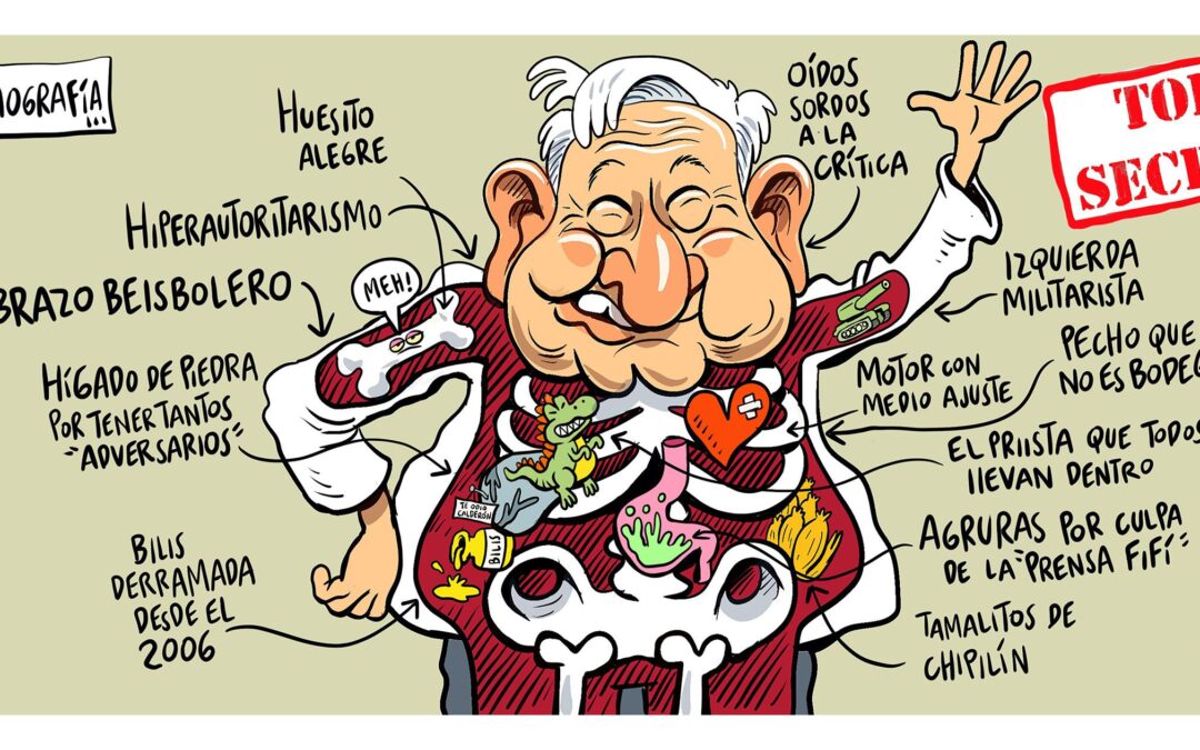 Radiografía