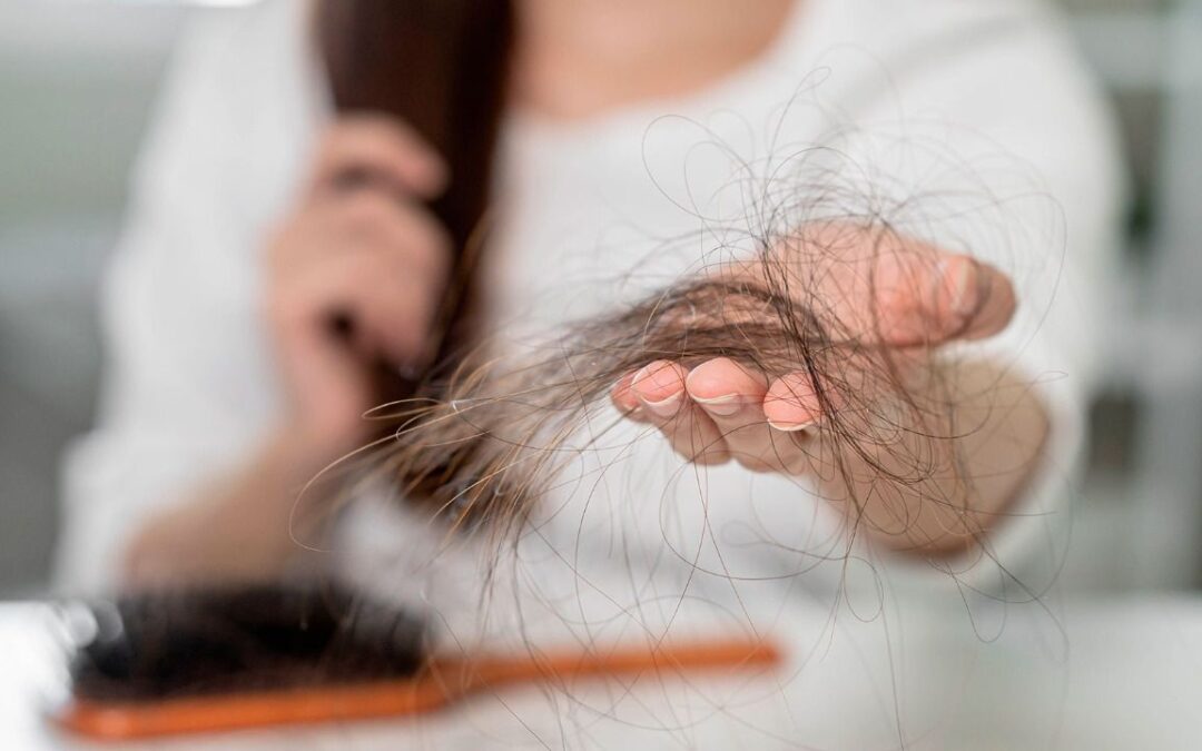 ¡No todo es culpa del COVID! Caída de cabello por estrés: cómo se revierte este efecto secundario