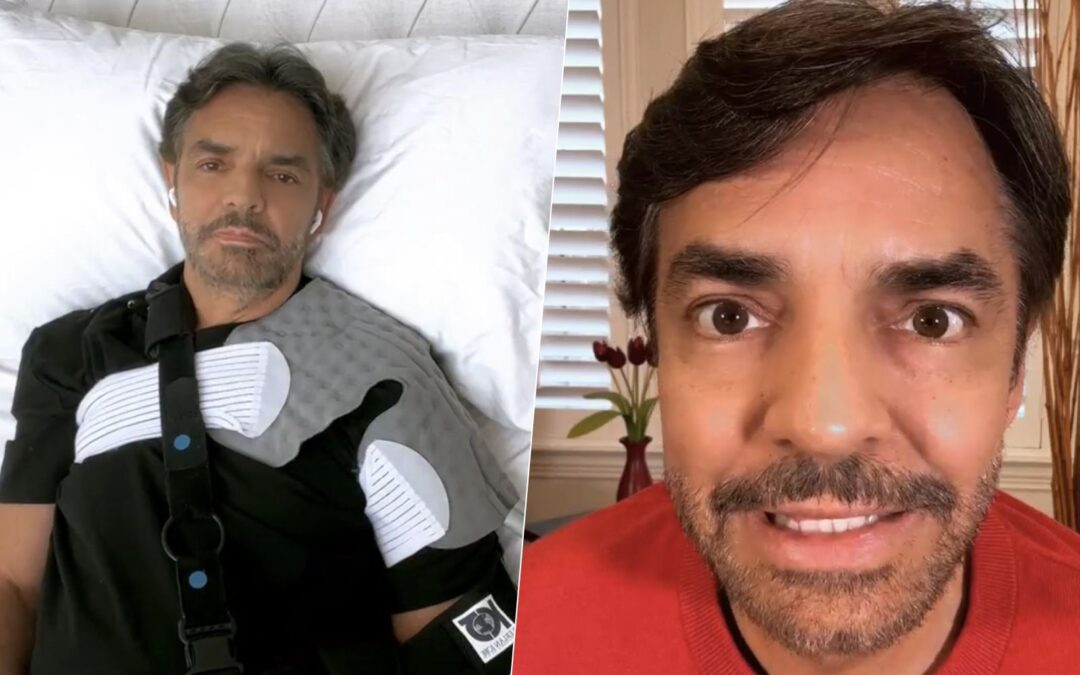 Eugenio Derbez dice cómo va su recuperación: ‘Me dijeron que no iba a poder levantar el brazo’