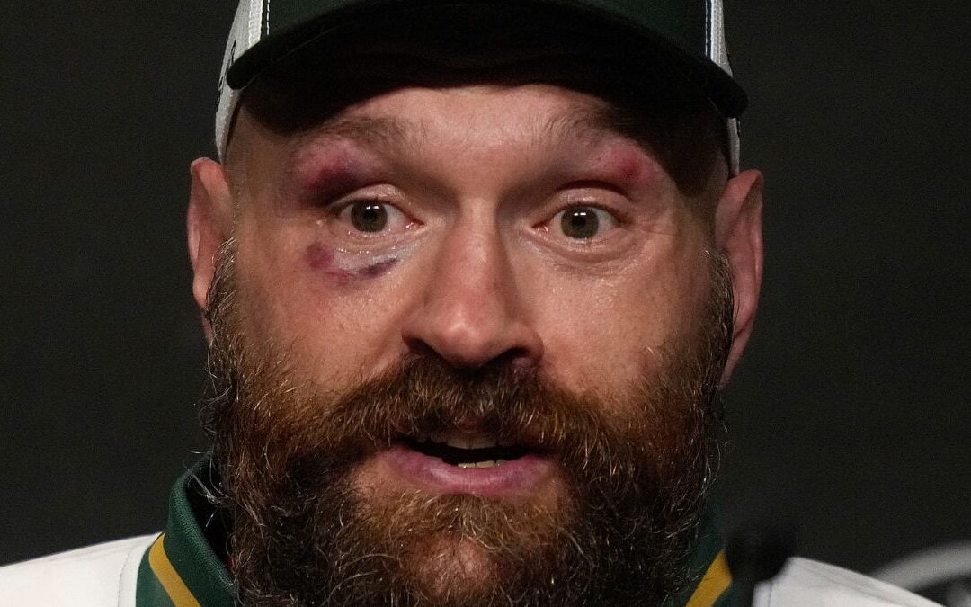 Tyson Fury anuncia su retiro del boxeo por quinta ocasión: ‘Nos vemos al otro lado’