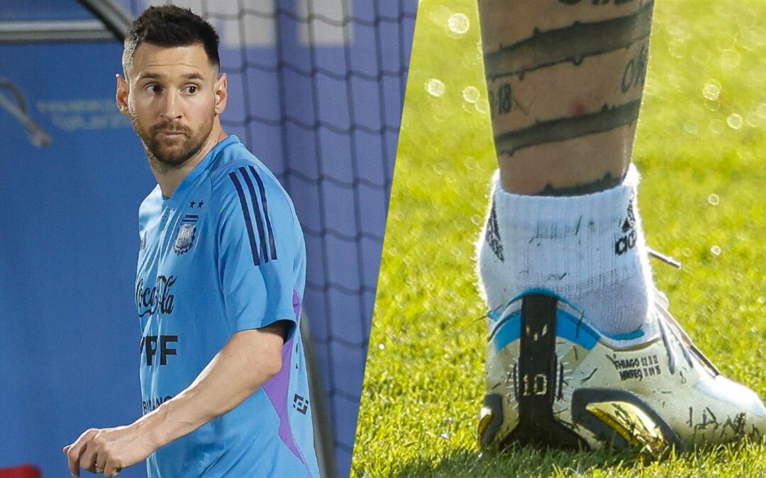 Qatar 2022: Foto del tobillo de Messi enciende las alarmas en Argentina previo a debut ante Arabia