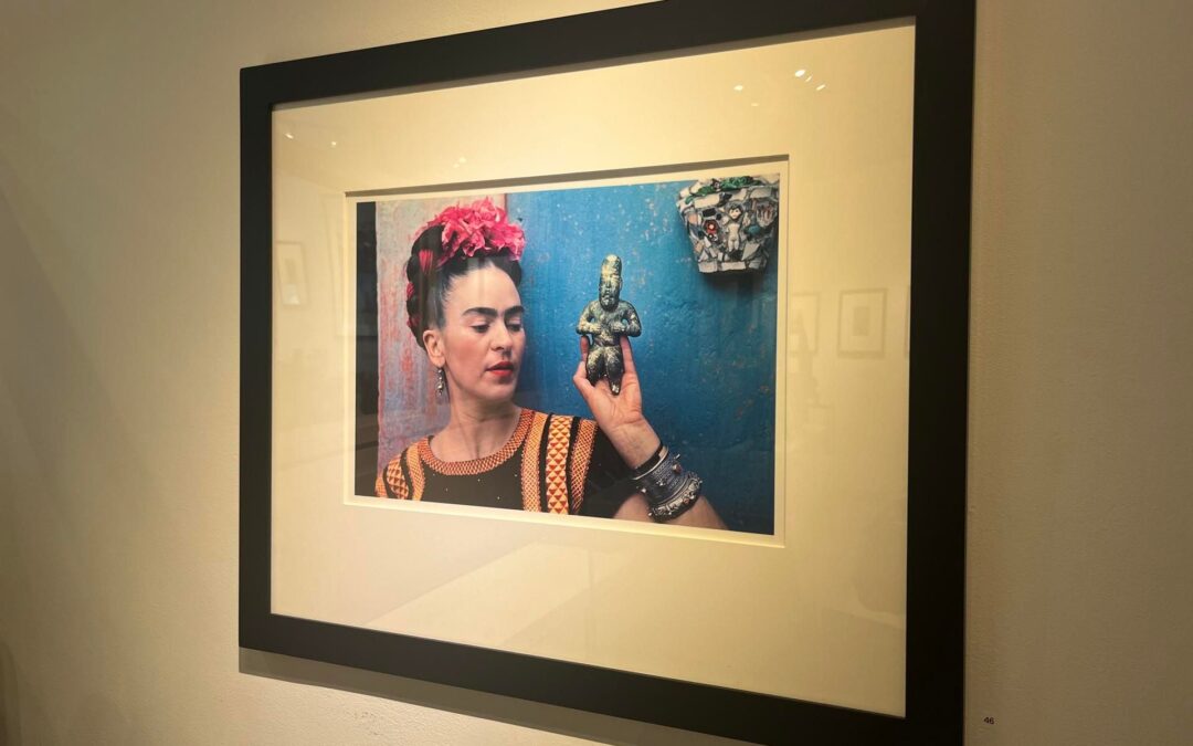 Investigación revela que Frida Kahlo tenía síndrome de cola de caballo: ¿qué es esta enfermedad?
