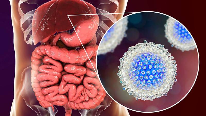 Hepatitis C: ¿Qué es y cómo se contagia?