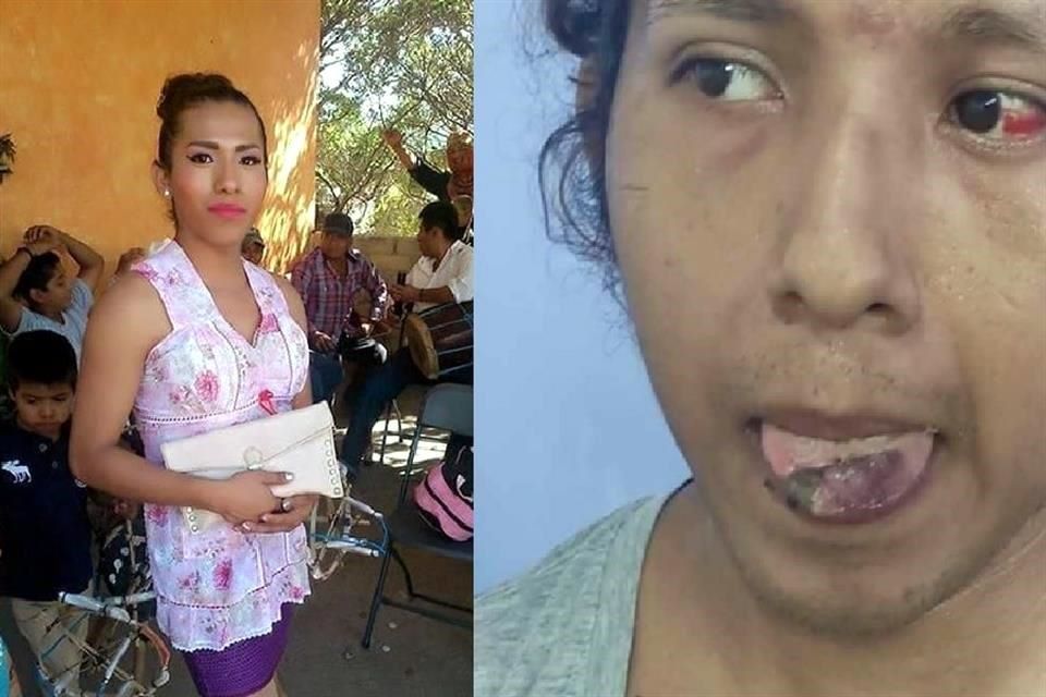 Hijos de ex alcalde de San Pedro Jicayán agreden a mujer trans en Oaxaca