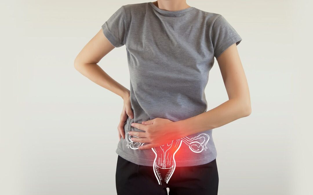 Cáncer de ovario: ¿Qué origina esta enfermedad y cuáles son los síntomas?