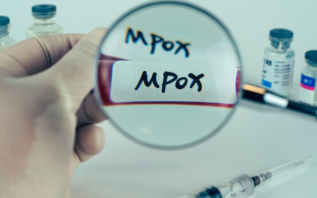 ‘Nace’ nueva cepa de la viruela del mono: ¿Por qué es más riesgosa para las mujeres? Estudio explica