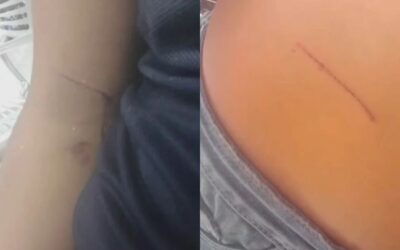 Alumna de Irapuato es atacada por su compañera con arma blanca; ahora toma clases a distancia
