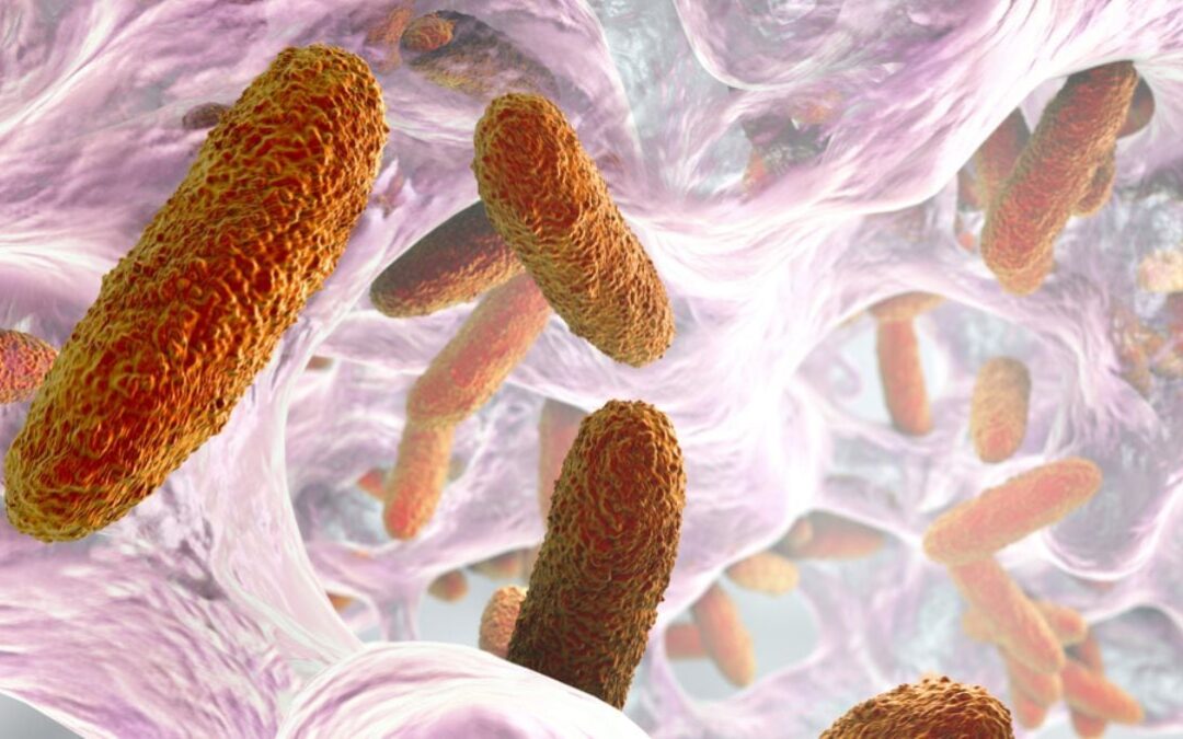 ¿Qué es la bacteria Klebsiella oxytoca en Edomex? Síntomas, causas y cómo se transmite