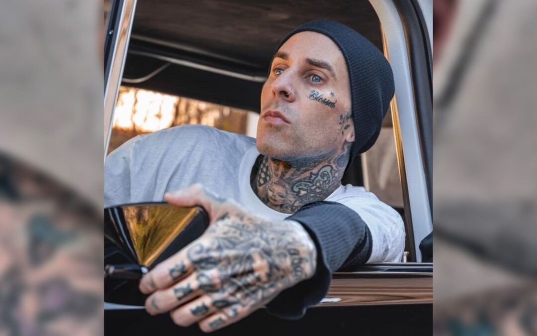 Travis Barker, baterista de Blink-182, comparte fotos tras operación: ‘Era inevitable’